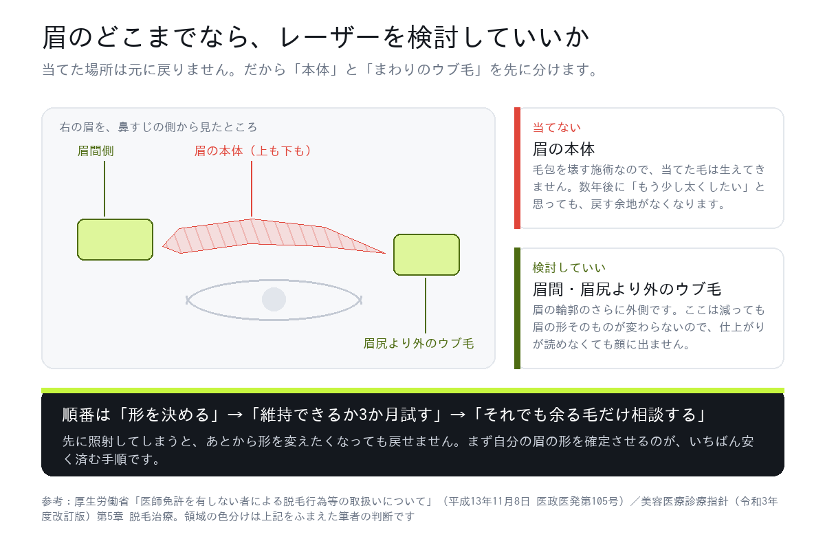 眉のどこまでならレーザーを検討していいか。眉の本体は当てない、眉間と眉尻より外のウブ毛は検討していい範囲