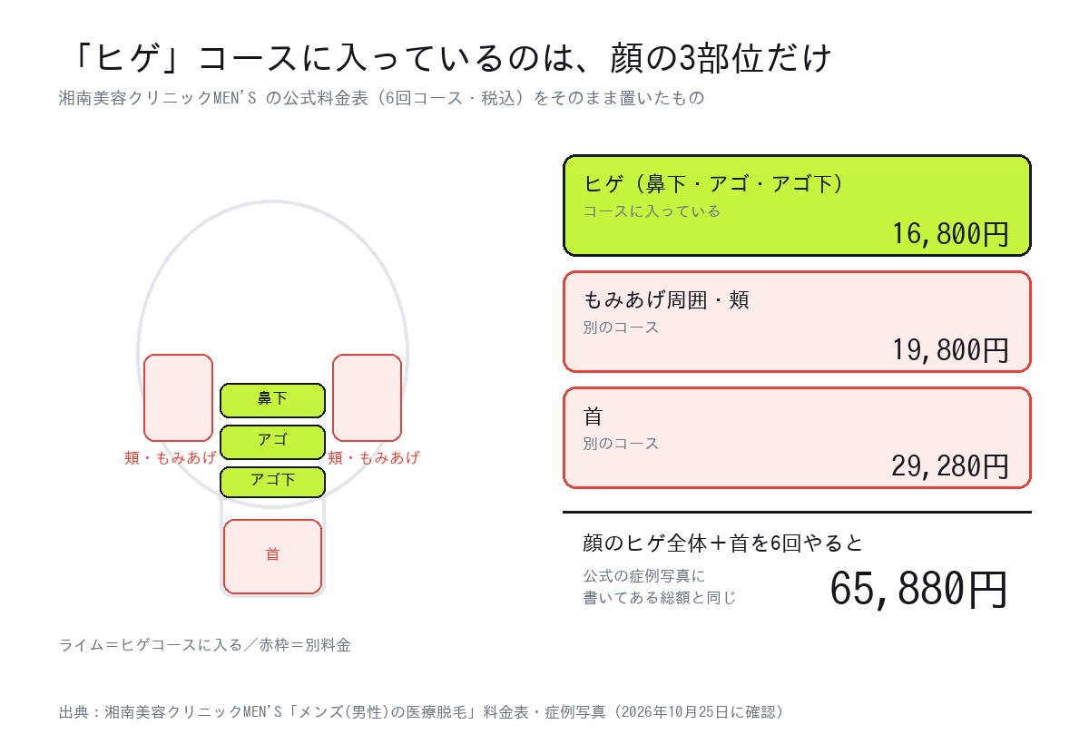 湘南美容クリニックのメンズ脱毛で、ヒゲ6回16,800円に入る鼻下・アゴ・アゴ下の3部位と、別料金のもみあげ周囲・頬19,800円・首29,280円を顔の図で示した図解
